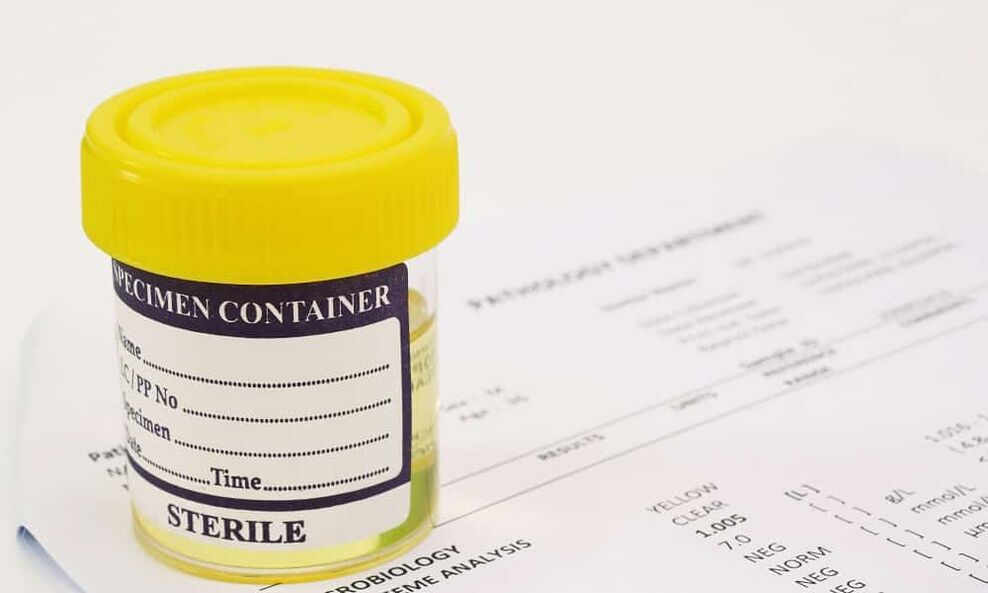 Преди да вземете антибиотици, трябва да си направите изследване на урината